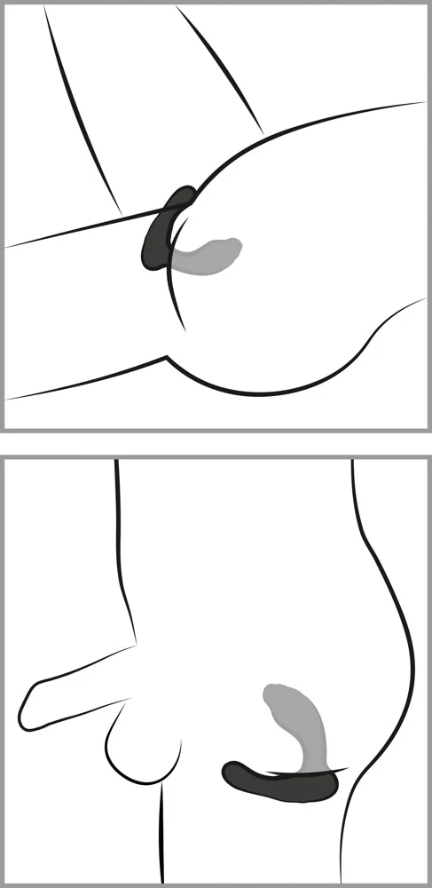 Smile RC G-&P-Spot Vibrator