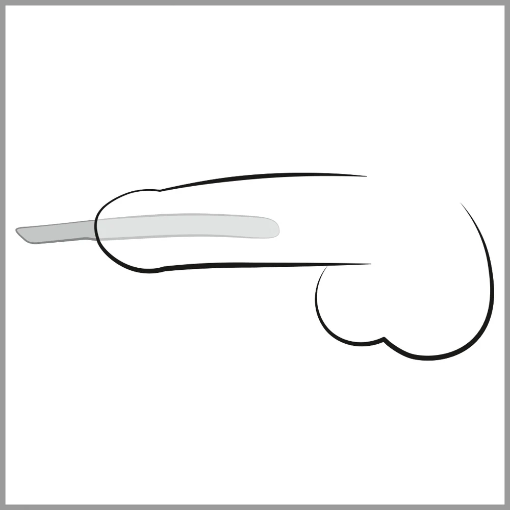 PPlug 14-Piece Dilator Set